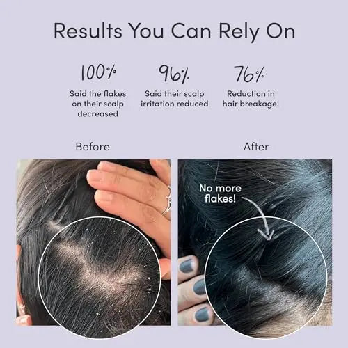 Jupiter Sulfate-Free Dandruff Shampoo & Conditioner  Relieves Dry, Itchy Scalp  9.5 fl oz Each