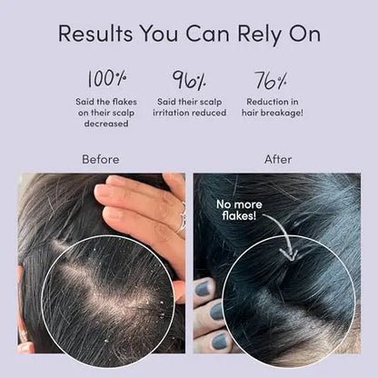 Jupiter Sulfate-Free Dandruff Shampoo & Conditioner  Relieves Dry, Itchy Scalp  9.5 fl oz Each