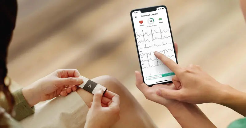 AliveCor KardiaMobile 6-Lead Personal EKG Monitor, FDA-Cleared, Smartphone Compatible, No Subscription Required