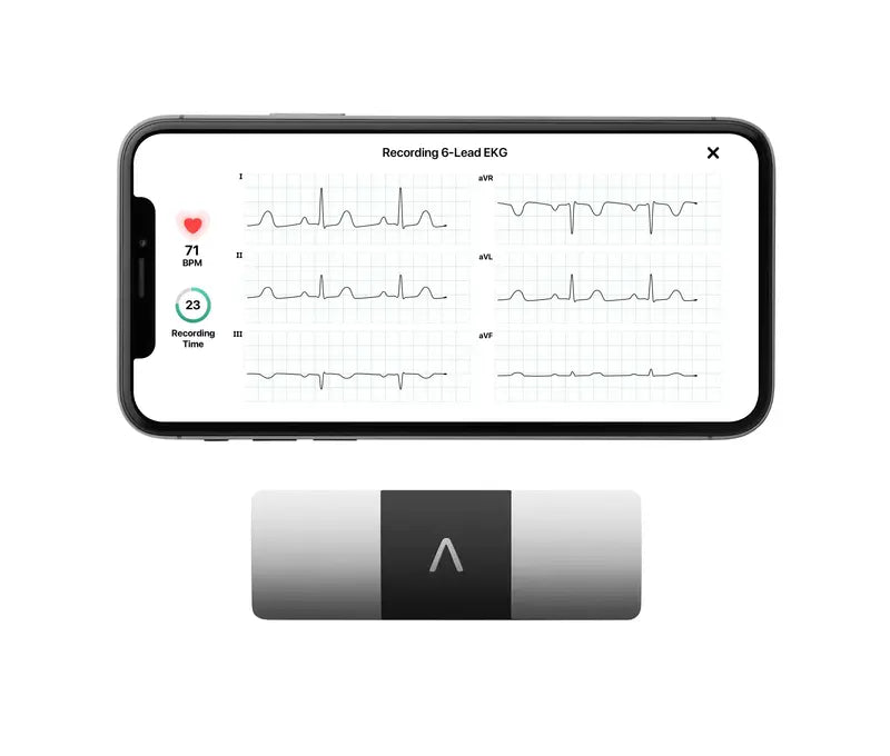 AliveCor KardiaMobile 6-Lead Personal EKG Monitor, FDA-Cleared, Smartphone Compatible, No Subscription Required