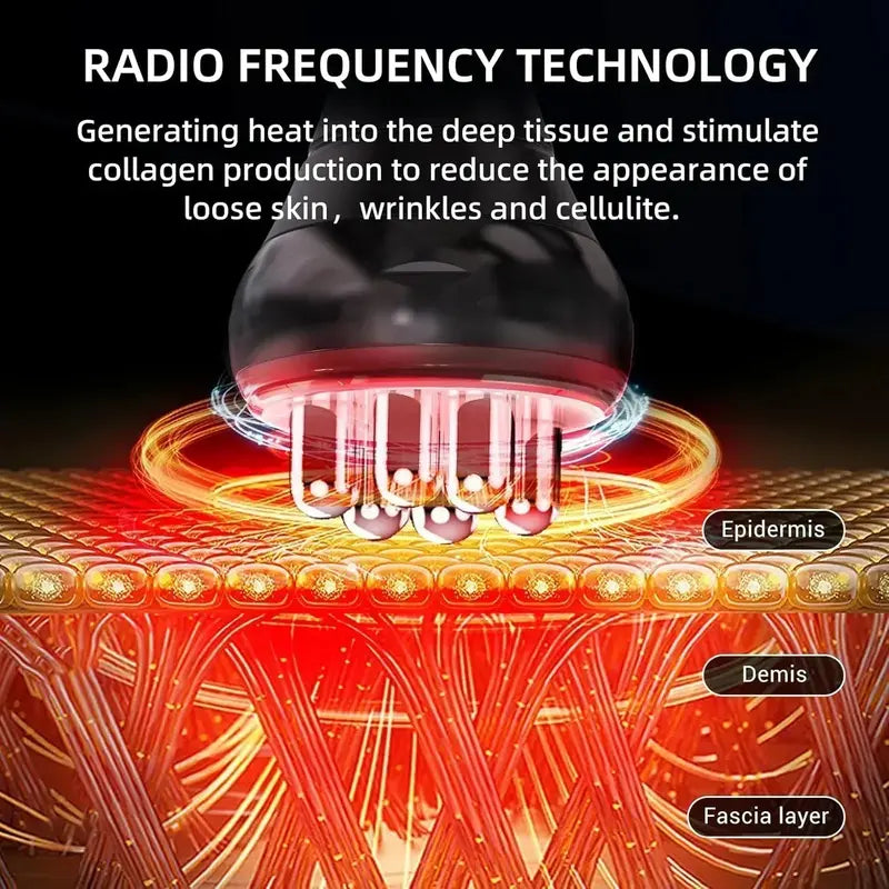 At-Home RF Cellulite Treatment Device  Handheld Radiofrequency Massager for Smoother Skin Texture