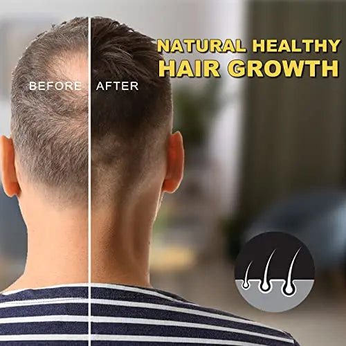 5% Minoxidil Biotin Serum for Hair Growth & Regrowth  2.02 oz  Natural Treatment for Thicker, Longer, Fuller Hair