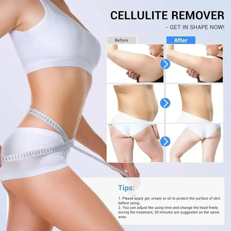 At-Home RF Cellulite Treatment Device  Handheld Radiofrequency Massager for Smoother Skin Texture