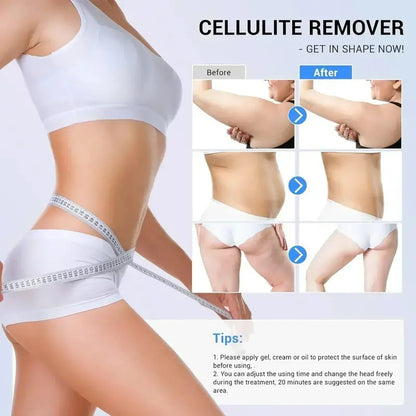 At-Home RF Cellulite Treatment Device  Handheld Radiofrequency Massager for Smoother Skin Texture