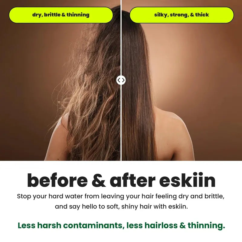 Eskiin Filtered Shower Head  Vitamin C & Mineral Filters for Healthier Hair and Skin