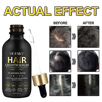 5% Minoxidil Biotin Serum for Hair Growth & Regrowth  2.02 oz  Natural Treatment for Thicker, Longer, Fuller Hair