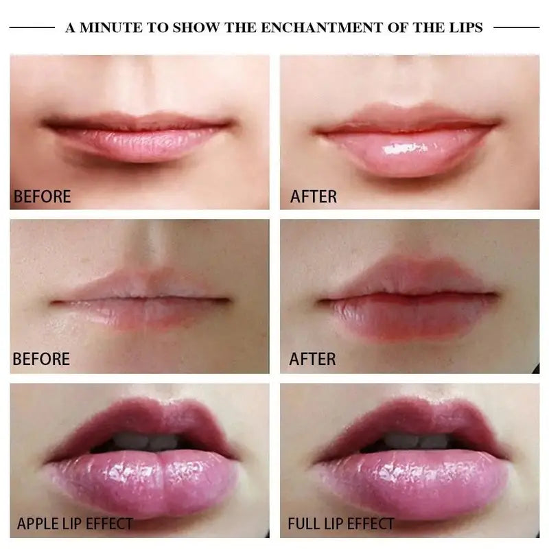 BrandName Premium Lip Plumper Device with Suction Technology, Multiple Power Levels, Rechargeable, Silica Gel Mouthpiece